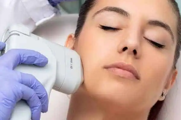Image of woman having HIFU Chigwell treatment