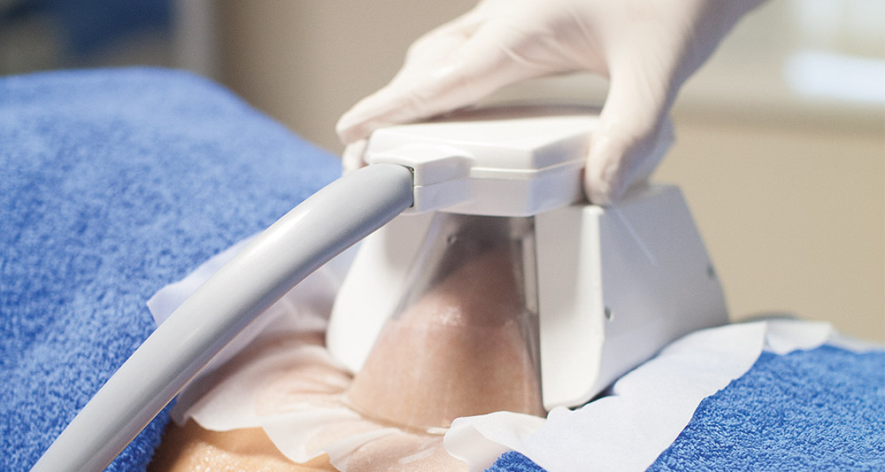 How Fat Freezing and HIFU Work Together? 2 Multiple Areas in One Session HIFU and Fat Freezing Chigwell