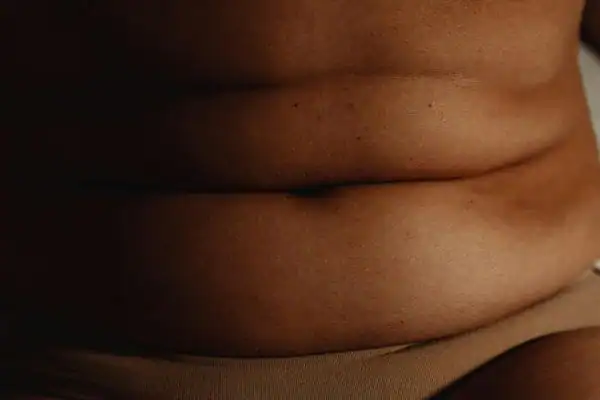 The Hidden Connection: How Stress Shapes Your Fitness and Body Composition 3 image of what stress can do on the stomach area and how Lipo 360 Chigwell can help to change your body shape.