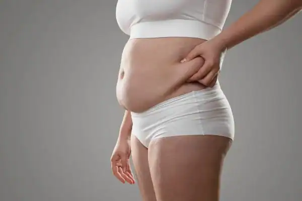 Image of stress belly Chigwell How Lipo 360 can help manage your symptoms